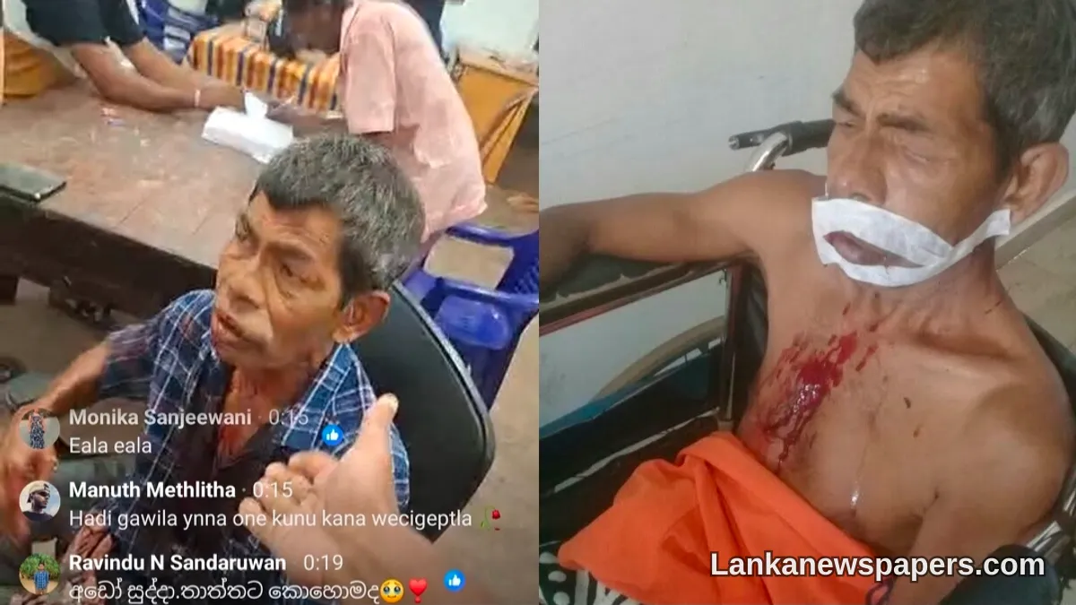Police Probe Underway After Family Claims Man Was Beaten in Custody at Ambalangoda Station