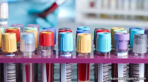 LNP - Coronavirus count in Sri Lanka climbs to 2,612