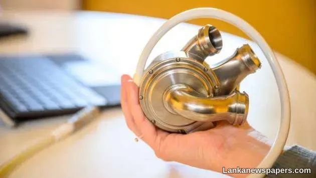 LNP - Australian man survives 100 days with artificial heart in world-first success