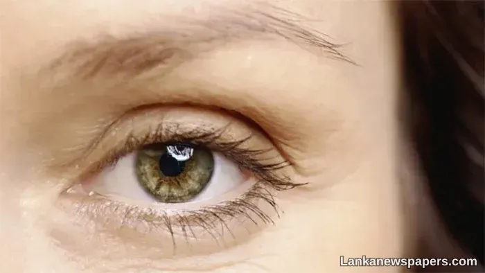 About 84% percent of Lankans willing to donate eyes