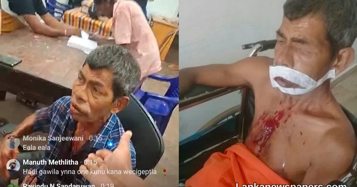 Police Probe Underway After Family Claims Man Was Beaten in Custody at Ambalangoda Station