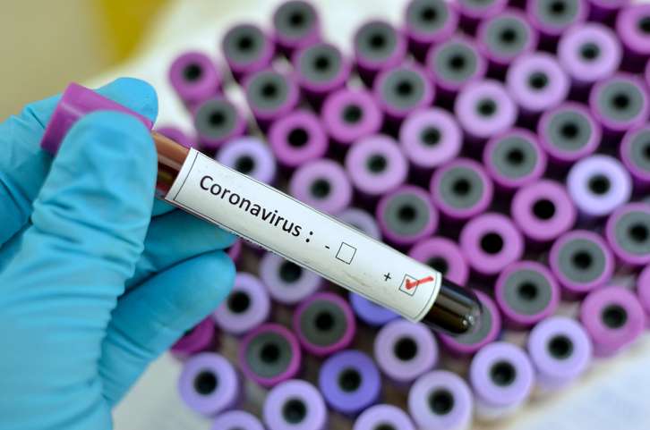 Number of COVID-19 patients rises to 70